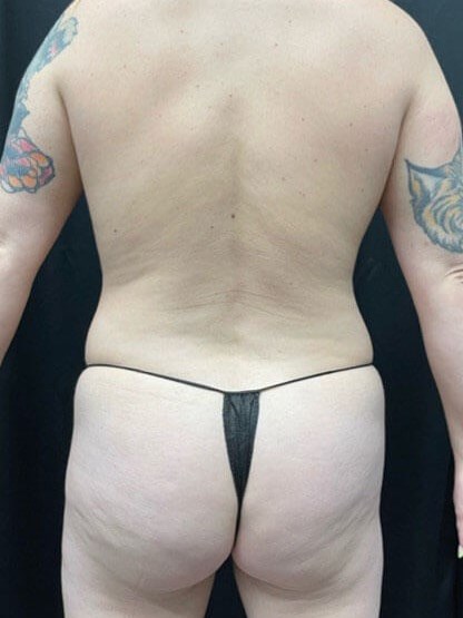 Before Image