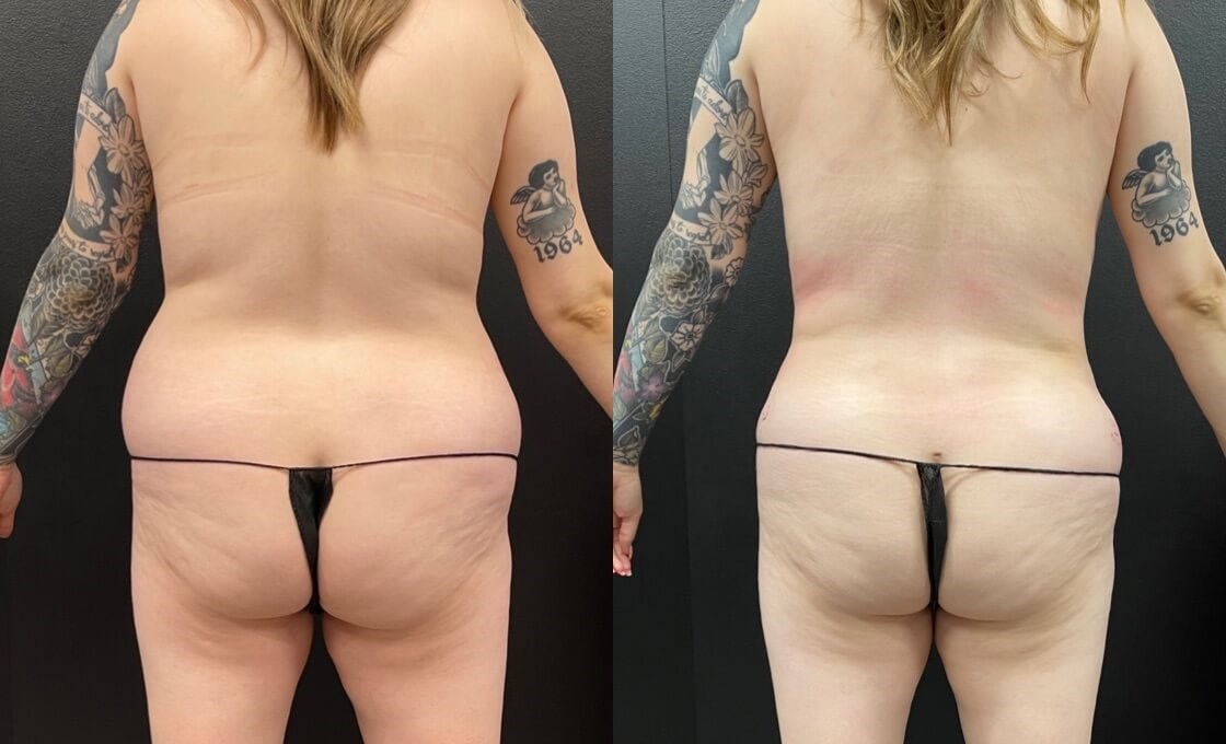 Reduce and Reshape Before