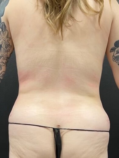 Reduce and Reshape After