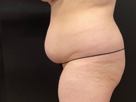 Reduce and Reshape Before