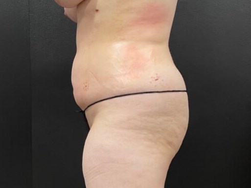 Reduce and Reshape After