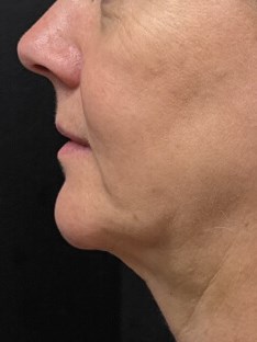 A totally different profile After