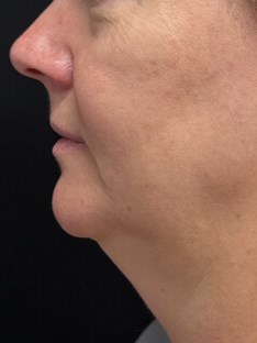 A totally different profile Before