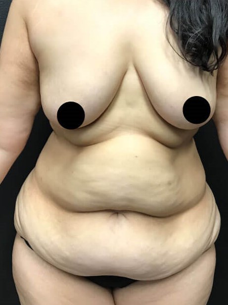 shape shifting Before