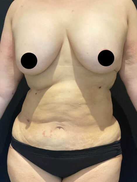 shape shifting After