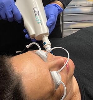 Woman Receving ClearLift Procedure